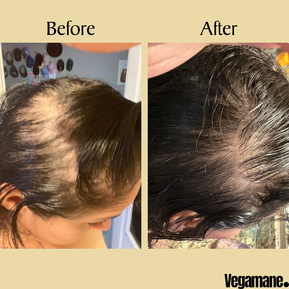 Vegamane™ - Rosemary Natural Hair Growth Oil (1+1 Free)